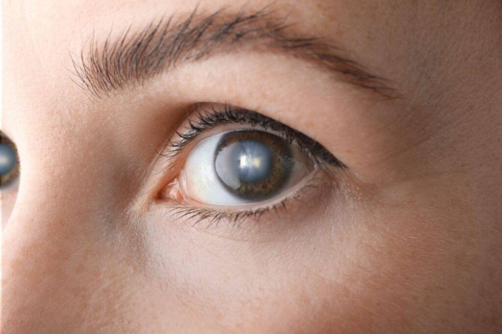 Health habits that protect your eyes against cataracts as seen here!